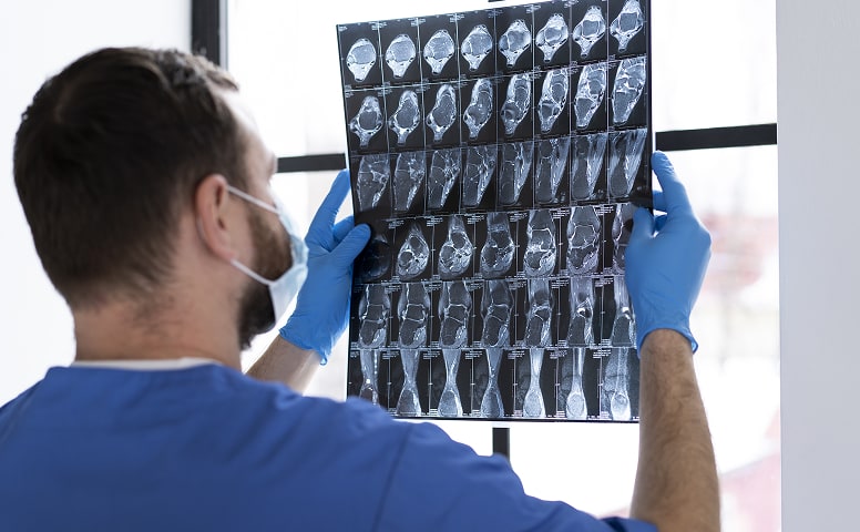 tomografia komputerowa